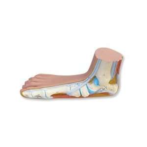  Flat Foot Model (Pes Panus): Health & Personal Care