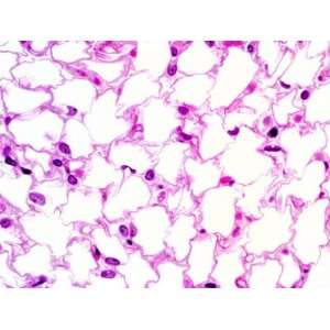 Human White Adipose Tissue or White Fat Tissue, H&E Stain Photographic 