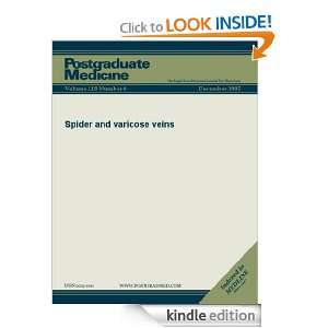 Spider and Varicose Veins (Postgraduate Medicine) JTE Multimedia 