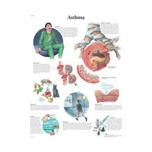 Asthma   Anatomical Chart  Industrial & Scientific
